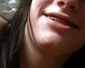 Giovane teen con bretelle video erotici gratuiti